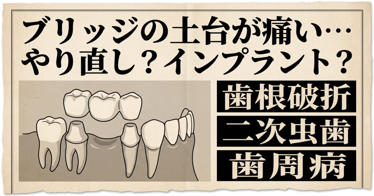ブリッジの土台が痛い…やり直すべき？インプラントとの判断基準を解説