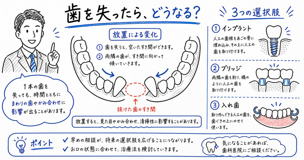 30代40代で歯を失ったら？放置リスクと早期治療の選び方を解説