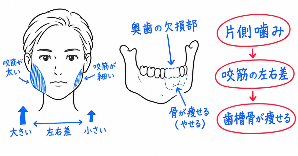 奥歯がない放置が顔の歪みや輪郭の非対称を招くメカニズム