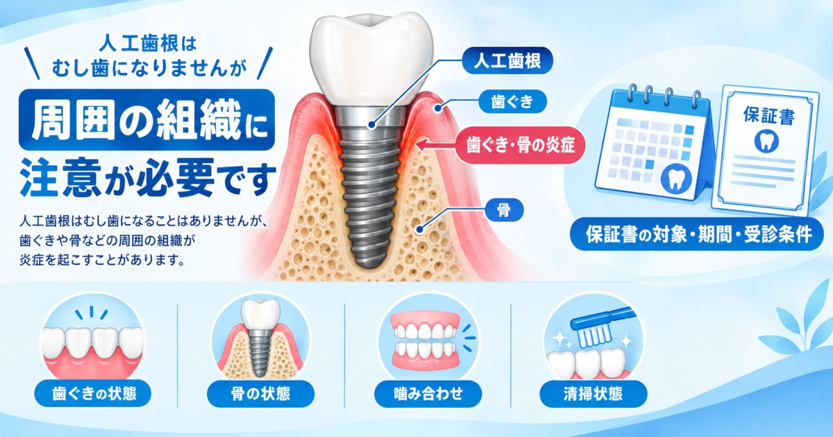虫歯にならない人工歯根も定期検診は必要！歯ぐきを守る理由と保証条件